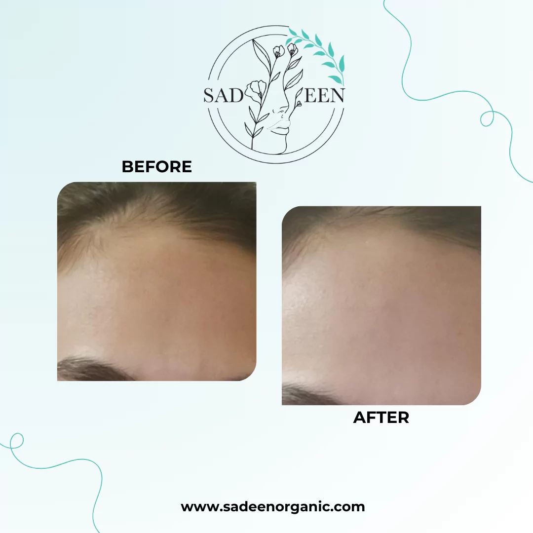 beige-minimal-photo-eyelash-extension-instagram-post-10-674b296e3aad5