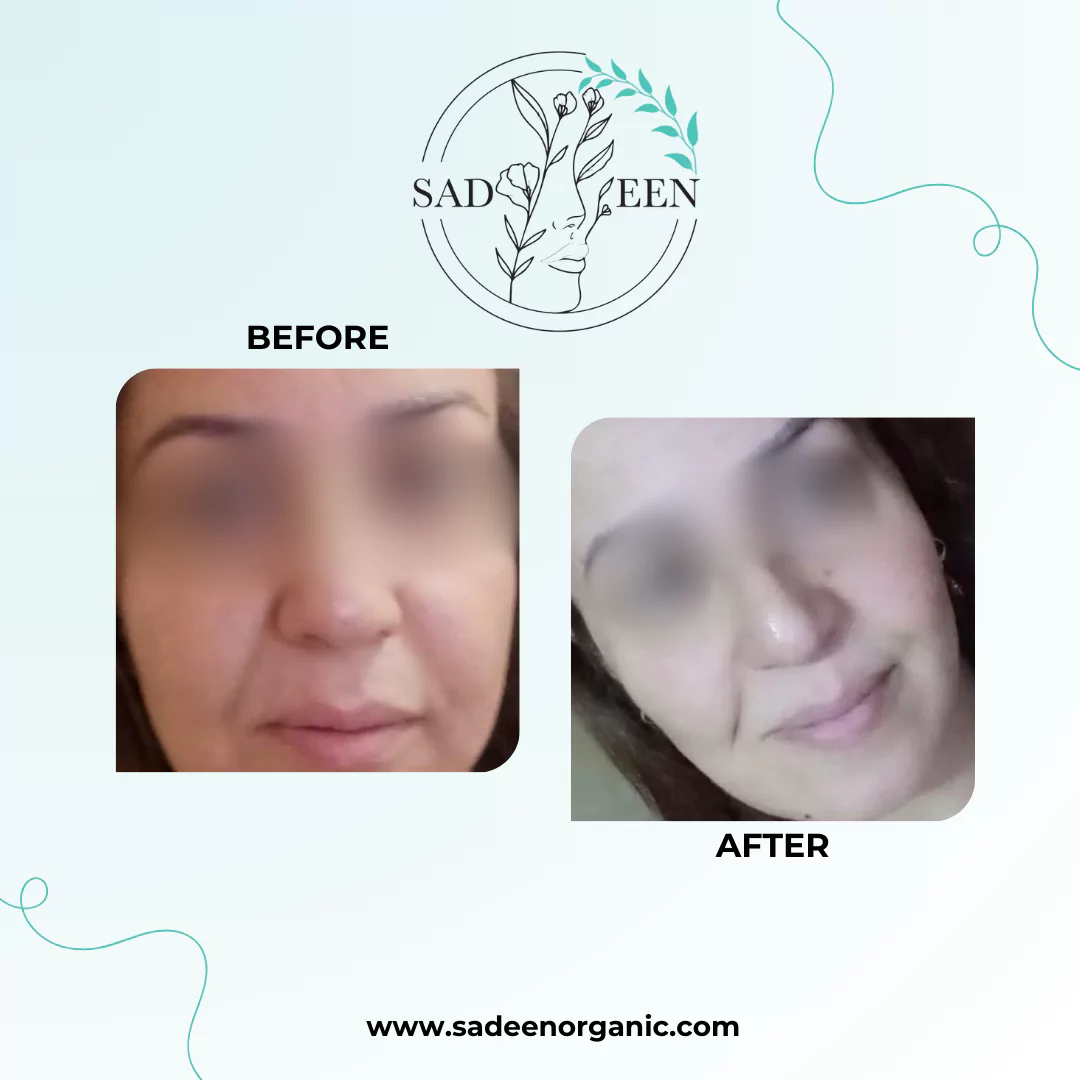 beige-minimal-photo-eyelash-extension-instagram-post-3-674b2975bdb15